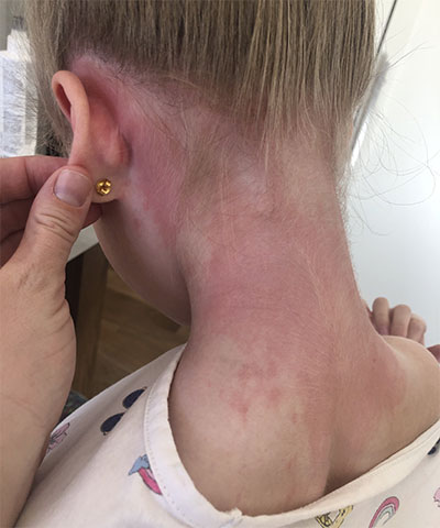 Reaction to non-siberian